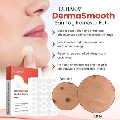 Derma Smooth Skin Tag Remover Patches (72 Patches)- Naturally, Safely, and Painlessly!